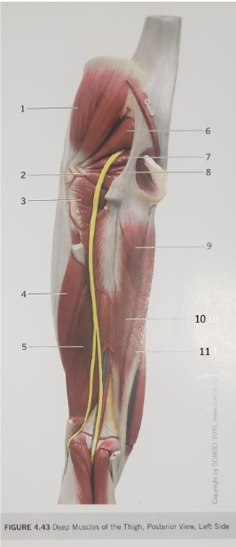 <p>Quadratus Femoris</p>