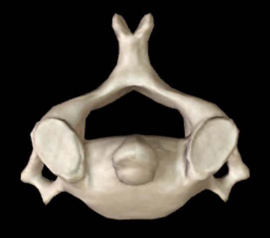 <p>Which bone is this?</p>