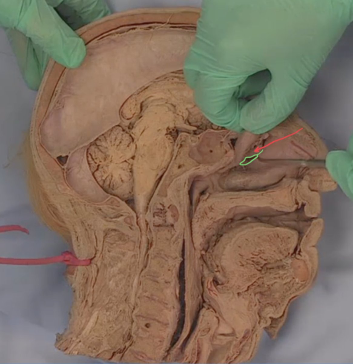 <p>identify red arrow (middle nasal conch reflected)</p>