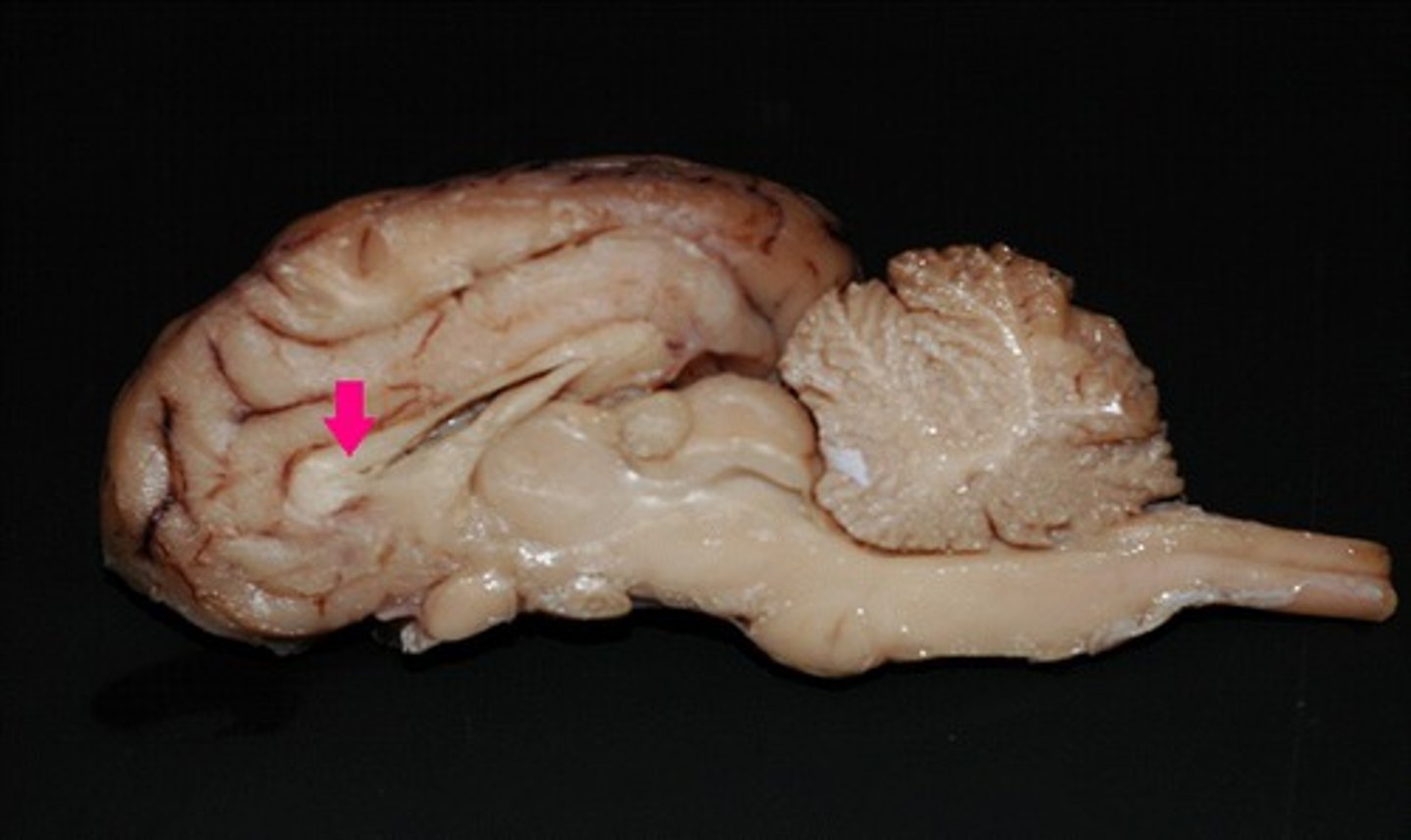 <p>Identify the structure.</p>