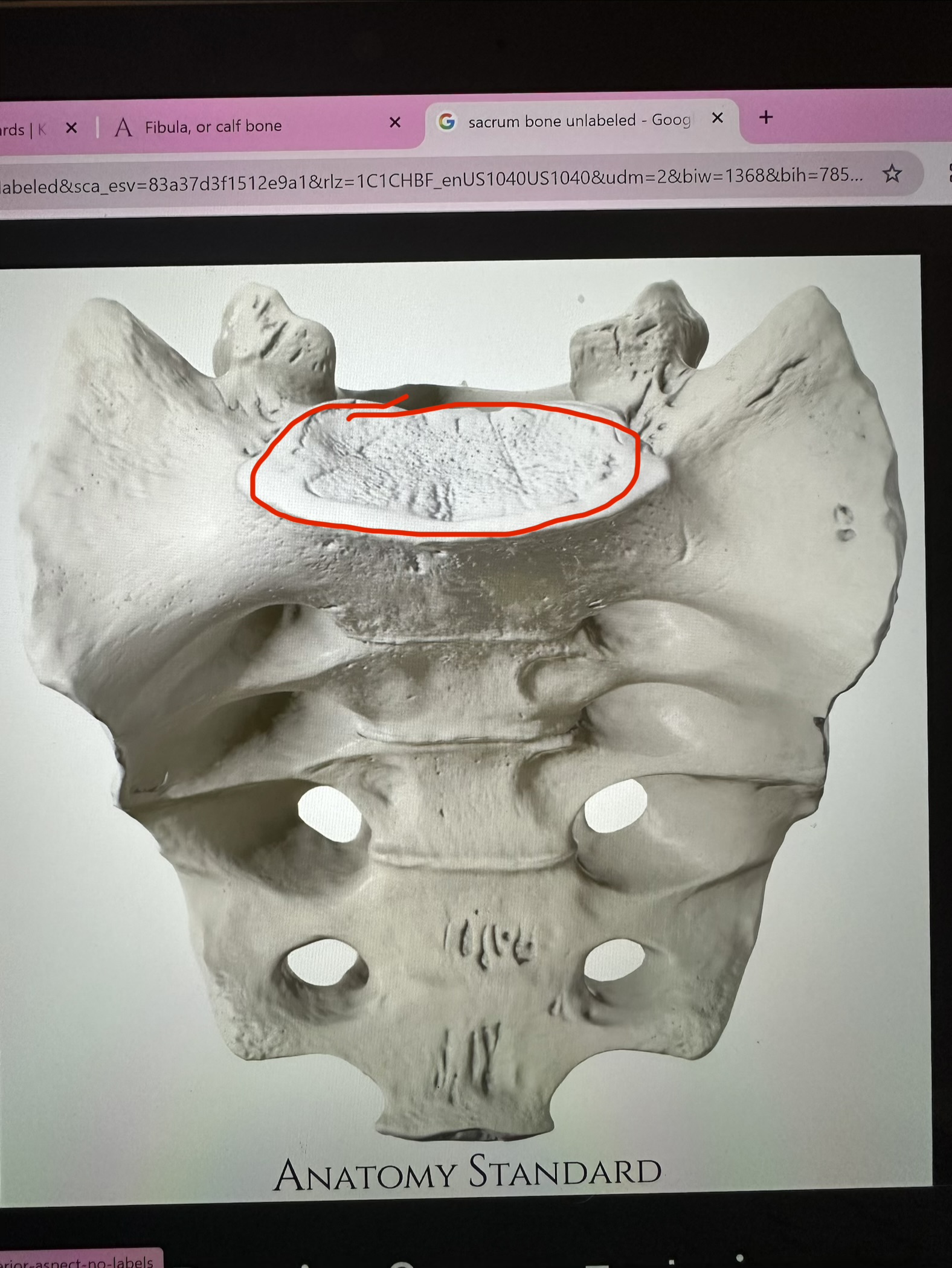 <p>sacrum, flat body articulates with spine</p>