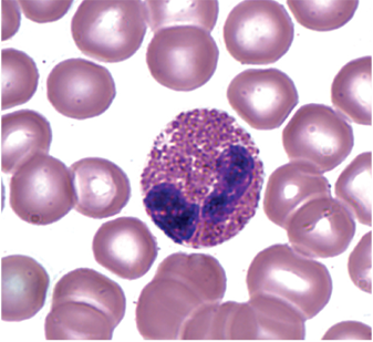 <p>Eosionophil</p>