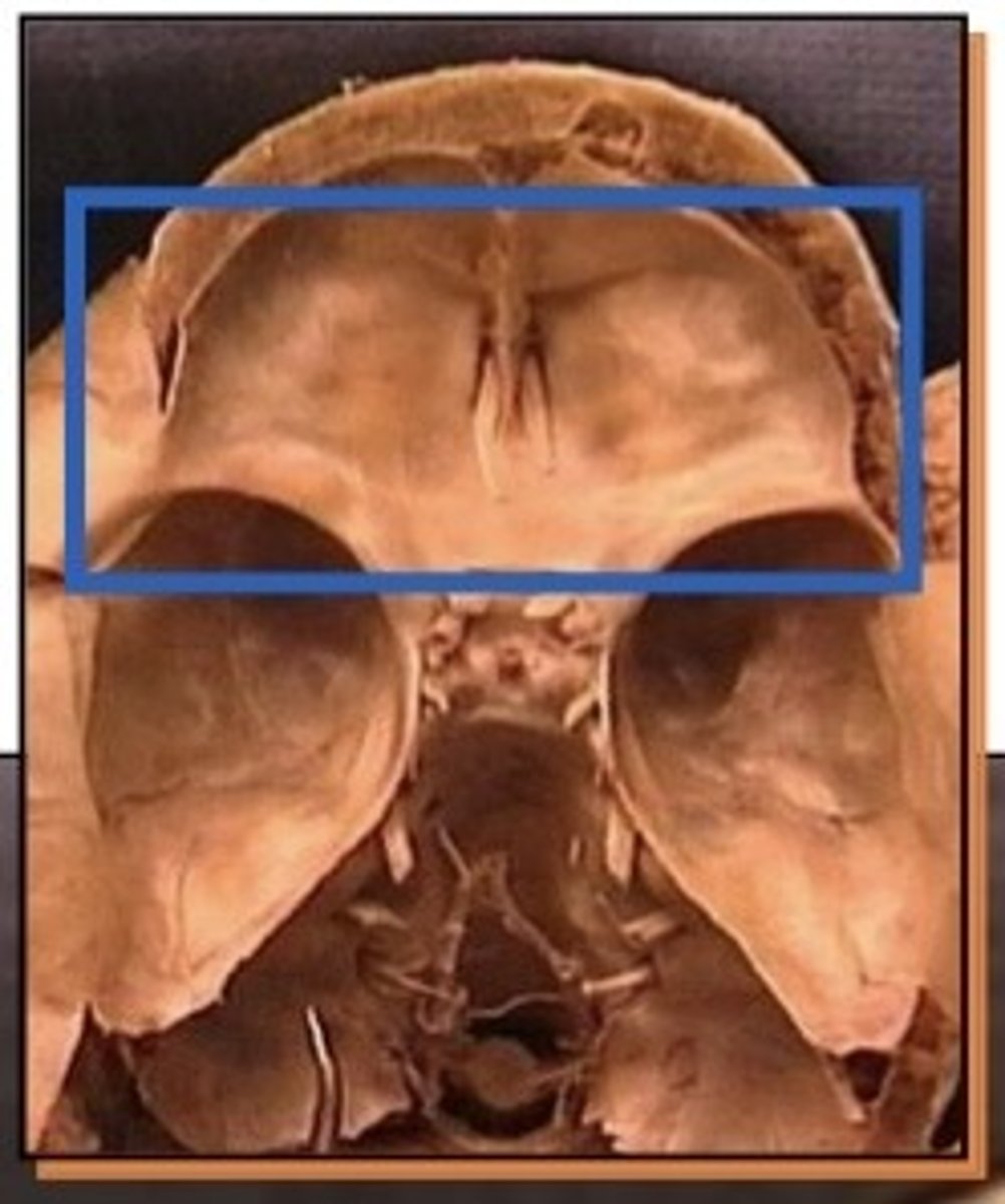 <p>1. Crista galli</p><p>2. Orbital plate of the frontal bone roof</p><p>3. Ethmoid (orbital plate, orbital cavity)</p>