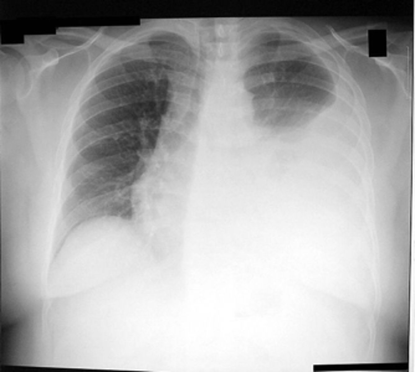 <p>what is the diagnosis?</p>
