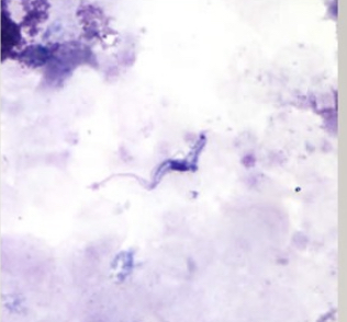 <p>A- what is the method of examination used here</p><p>B-identify the used technique</p><p>C- what is the type of this technique in this picture</p><p>D - how to use it</p><p>E- what its importance</p>