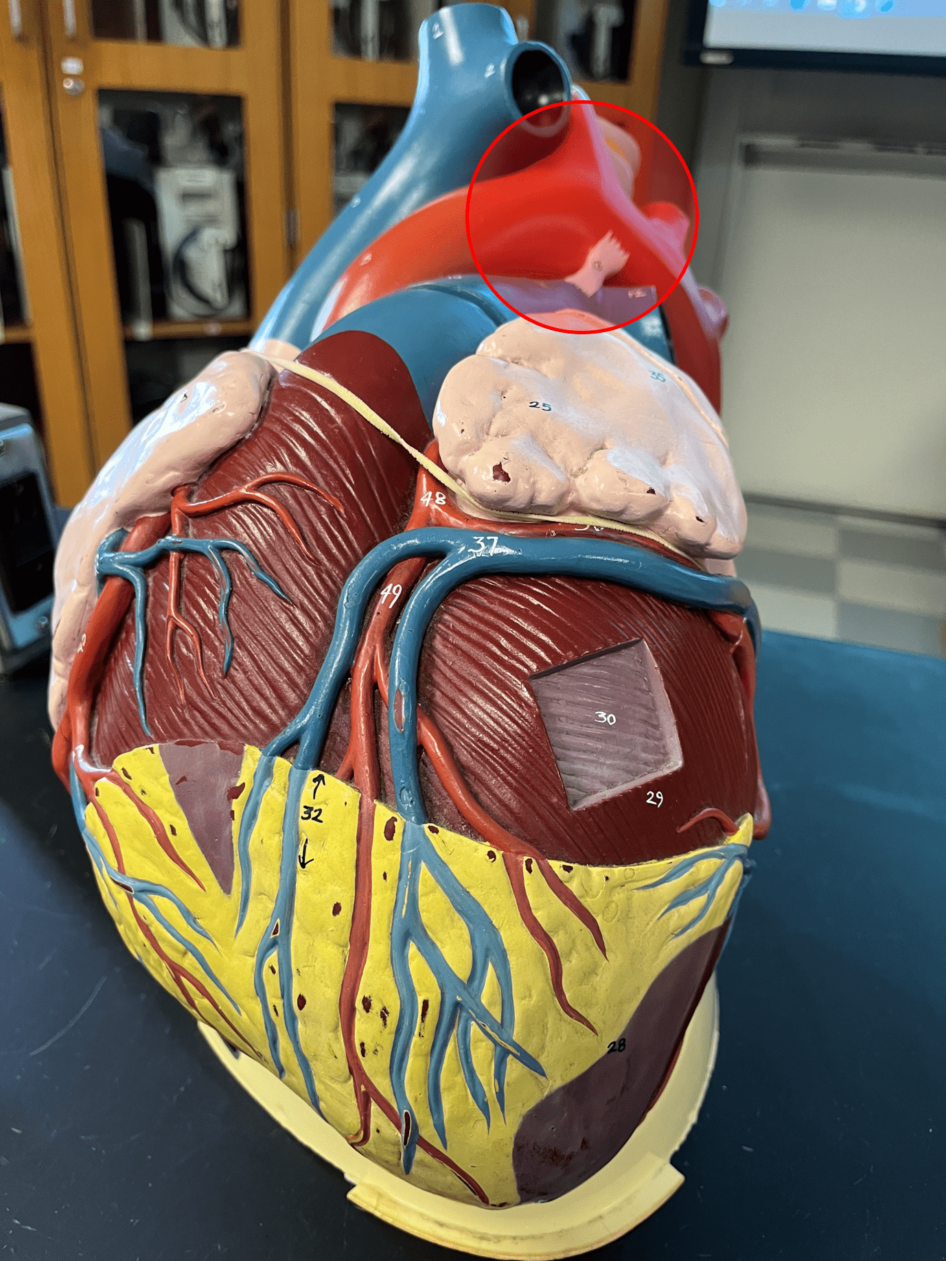 • A great vessel of the heart.

• Carries oxygenated blood to the systemic circuit.

• Divided into ascending, arch-shaped, and descending portions.