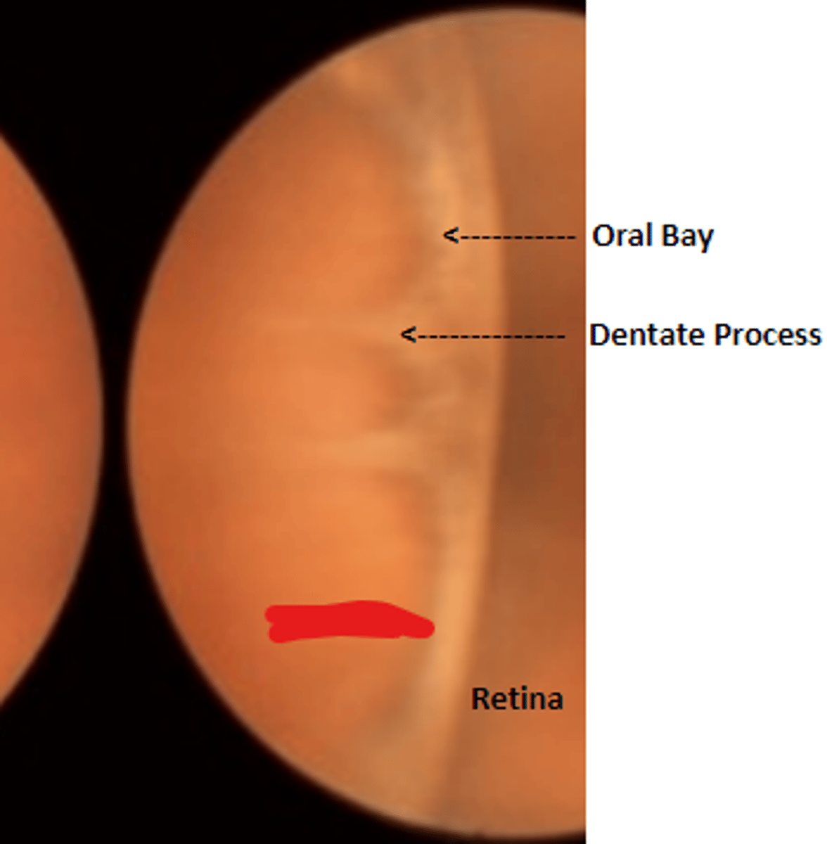 <p>brown anatomical landmark extending from the ora serrata to the ciliary processes</p>