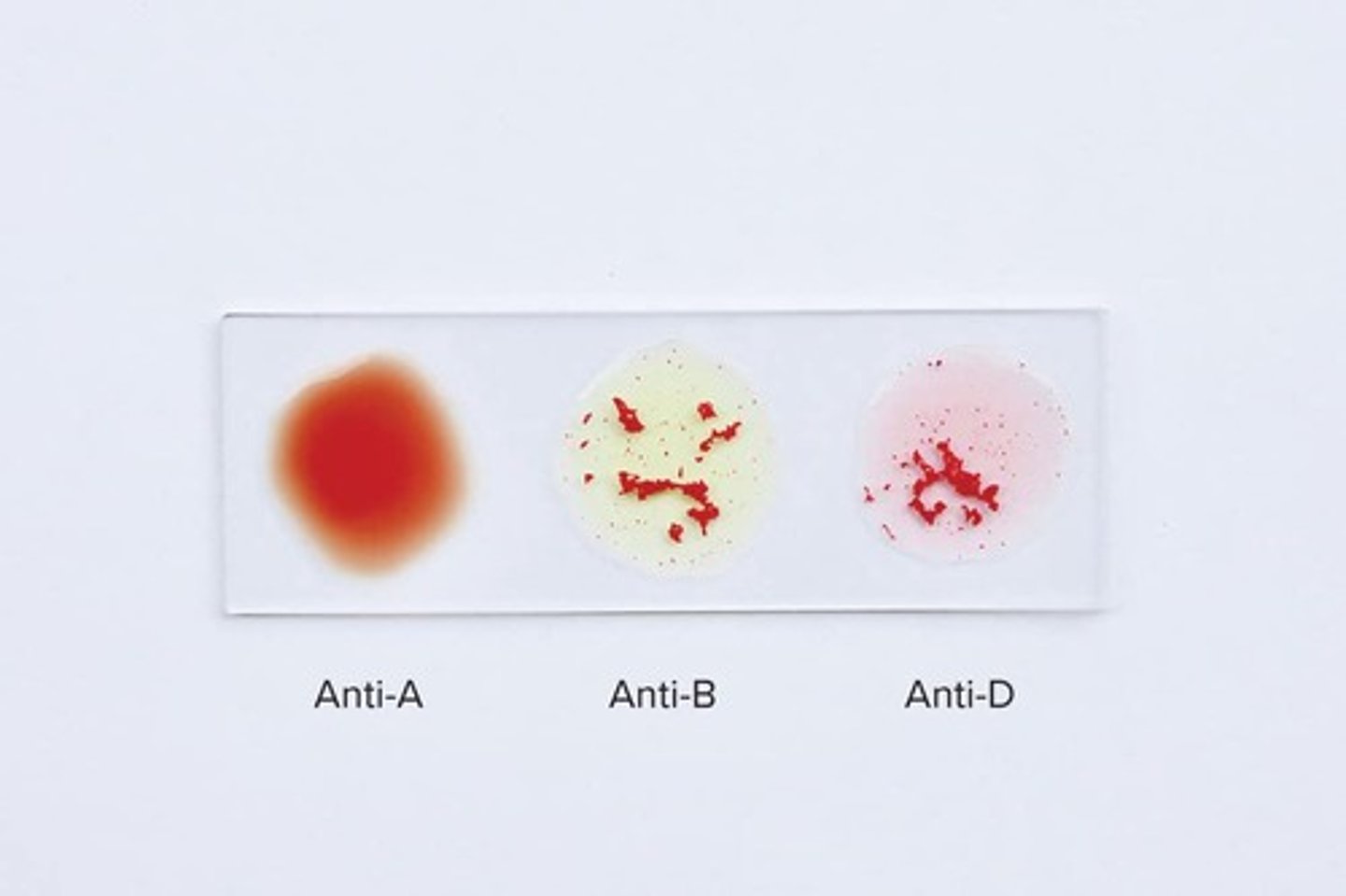 <p>Antibodies bind to RBC antigens, causing clumping or hemolysis.</p>