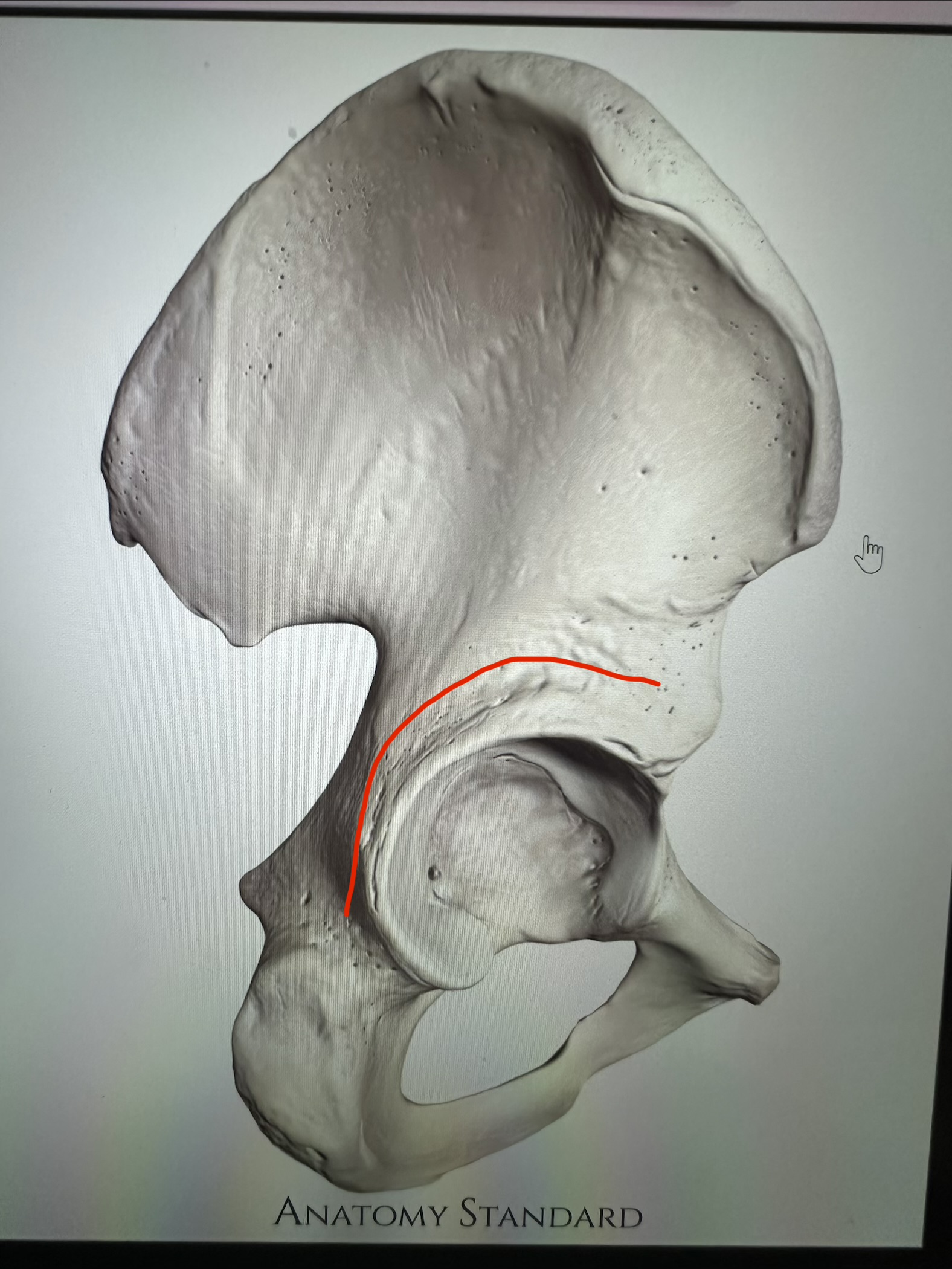 <p>os coxae, crown above acetabulum</p>