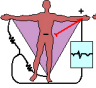 <p>Which augmented lead takes an image of the left side of the body?</p>