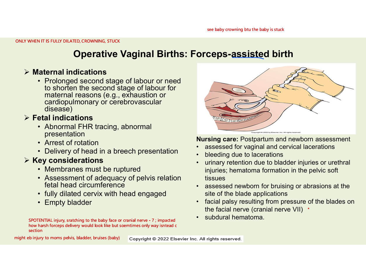 <ul><li><p>maternal indications</p><ul><li><p>prolonged seocnd stage of labour or need to shroten the second stage of labour for maternal reasons (ex. exhaustion or cardiopulmonary or cerebrovascular disease)</p></li></ul></li><li><p>fetal indications</p><ul><li><p>abnormal FHR tracing, abnormal presentation</p></li><li><p>arrest of rotation</p></li><li><p>delivery of head in breech presentation</p></li></ul></li><li><p>key consdieration</p><ul><li><p>membranes msut be ruptured</p></li><li><p>assessment of adequacy of pelvis relation fetal head and cicumference</p></li><li><p>fully dialted cervix with head engaged</p></li><li><p>emtpy bladder</p></li></ul></li><li><p>nursing care</p><ul><li><p>PP and newborn assessment</p></li><li><p>assessed for vaginal and cervical lacerations •</p></li><li><p> bleeding due to lacerations •</p></li><li><p> urinary retention due to bladder injuries or urethral injuries; hematoma formation in the pelvic soft tissues </p></li><li><p>• assessed newborn for bruising or abrasions at the site of the blade applications</p></li><li><p> • facial palsy resulting from pressure of the blades on the facial nerve (cranial nerve VII)</p></li><li><p> • subdural hematoma.</p></li></ul></li></ul><p></p>