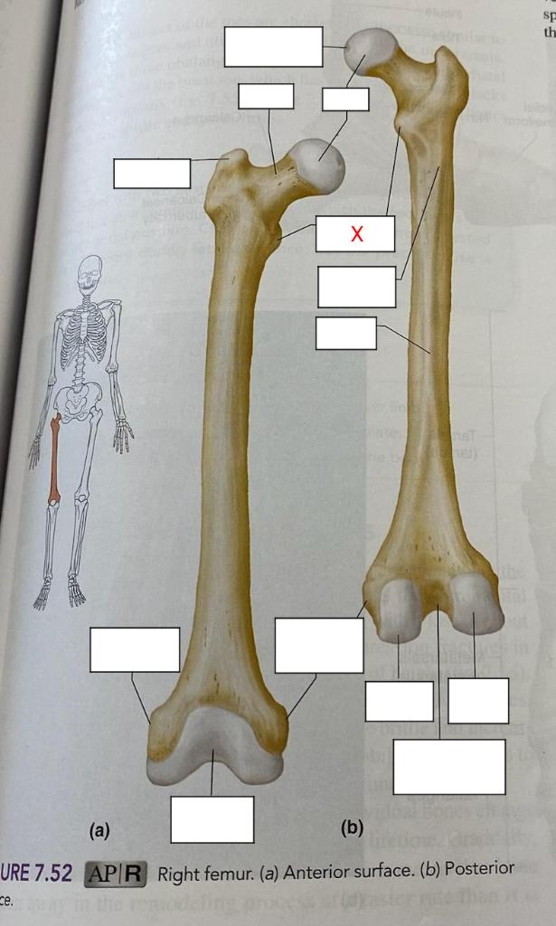 prominent for attachment of large buttocks muscles