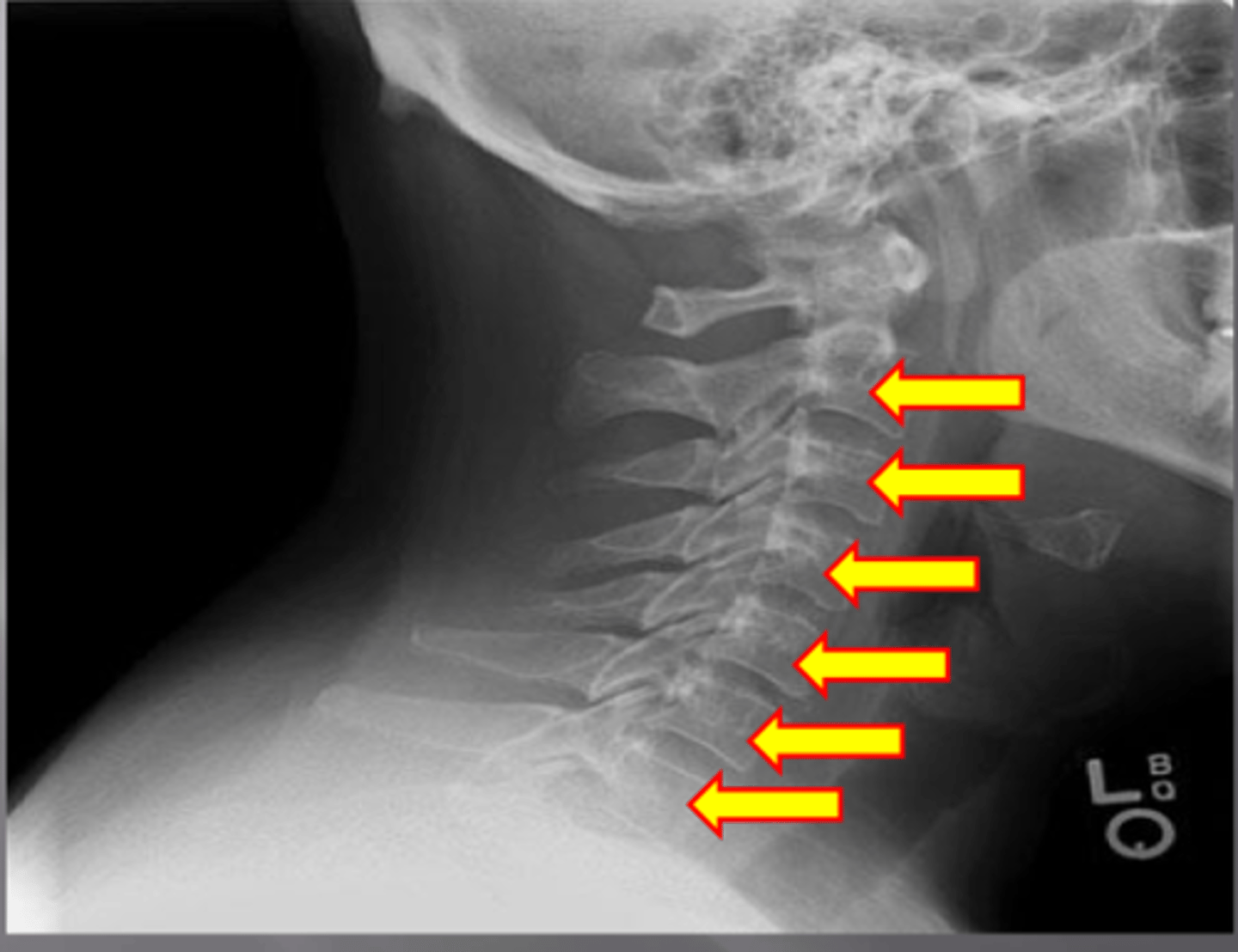 <p>What feature is shown here?</p>