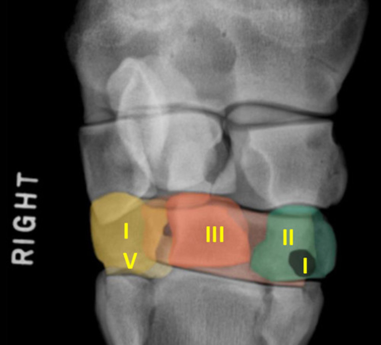 <p>What is highlighted in orange/red?</p>