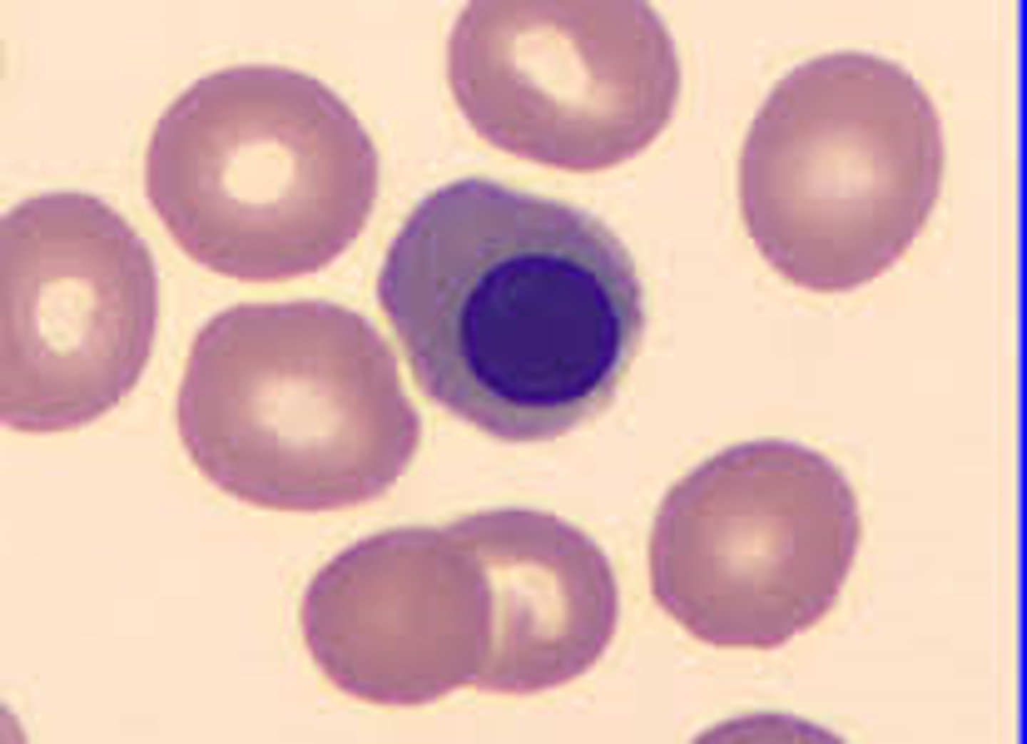 <p>Smallest cell in the RBC maturation series. These cells have a condenses nucleus and a red cytoplasm. These cells cannot divide. Hemoglobin formation finishes in this stage.</p>