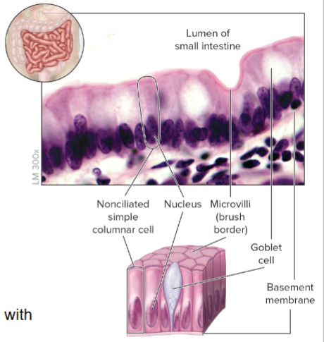 NonCiliated Simple Columnar