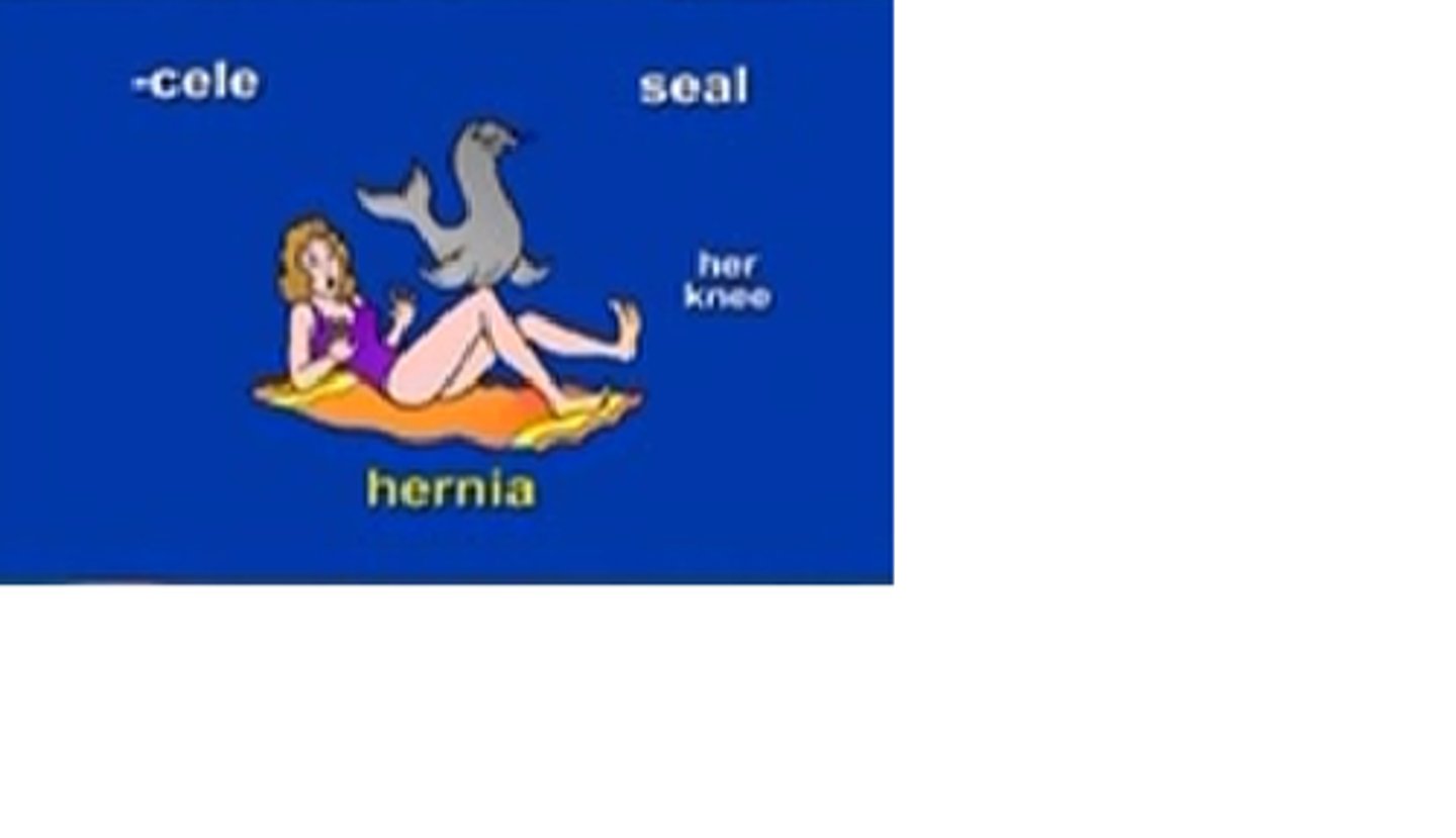 <p>hernia</p>