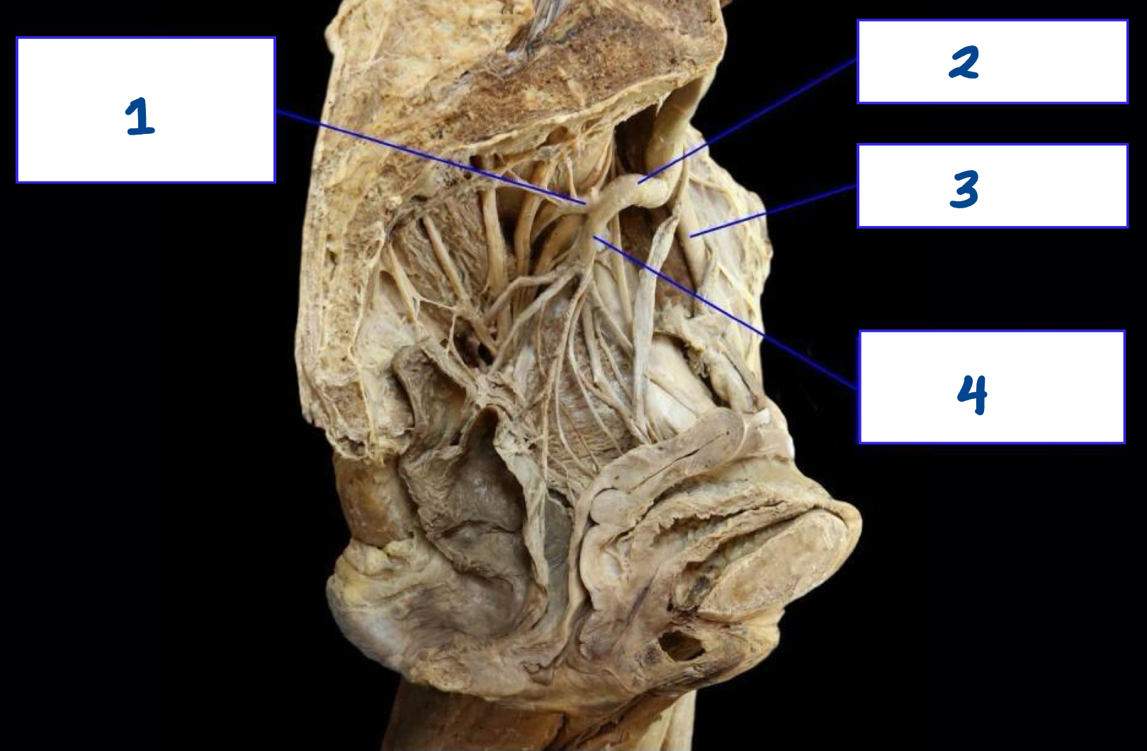<p>What is structure 2?</p>