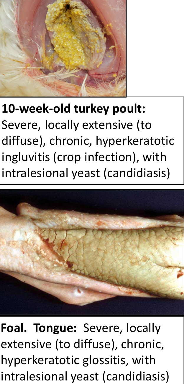 <ul><li><p>A disease of the tongue</p></li><li><p>An infection of the keratinized epithelium of the tongue</p><ul><li><p>Presents as a yellow/grey/green pseudomembrane</p></li><li><p>Can be easily scraped off</p></li></ul></li><li><p>Etiology</p><ul><li><p>Candida Albicans</p></li></ul></li></ul><p></p>