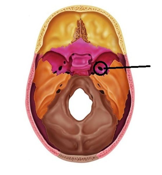 <p>Round or oval opening through a bone</p>