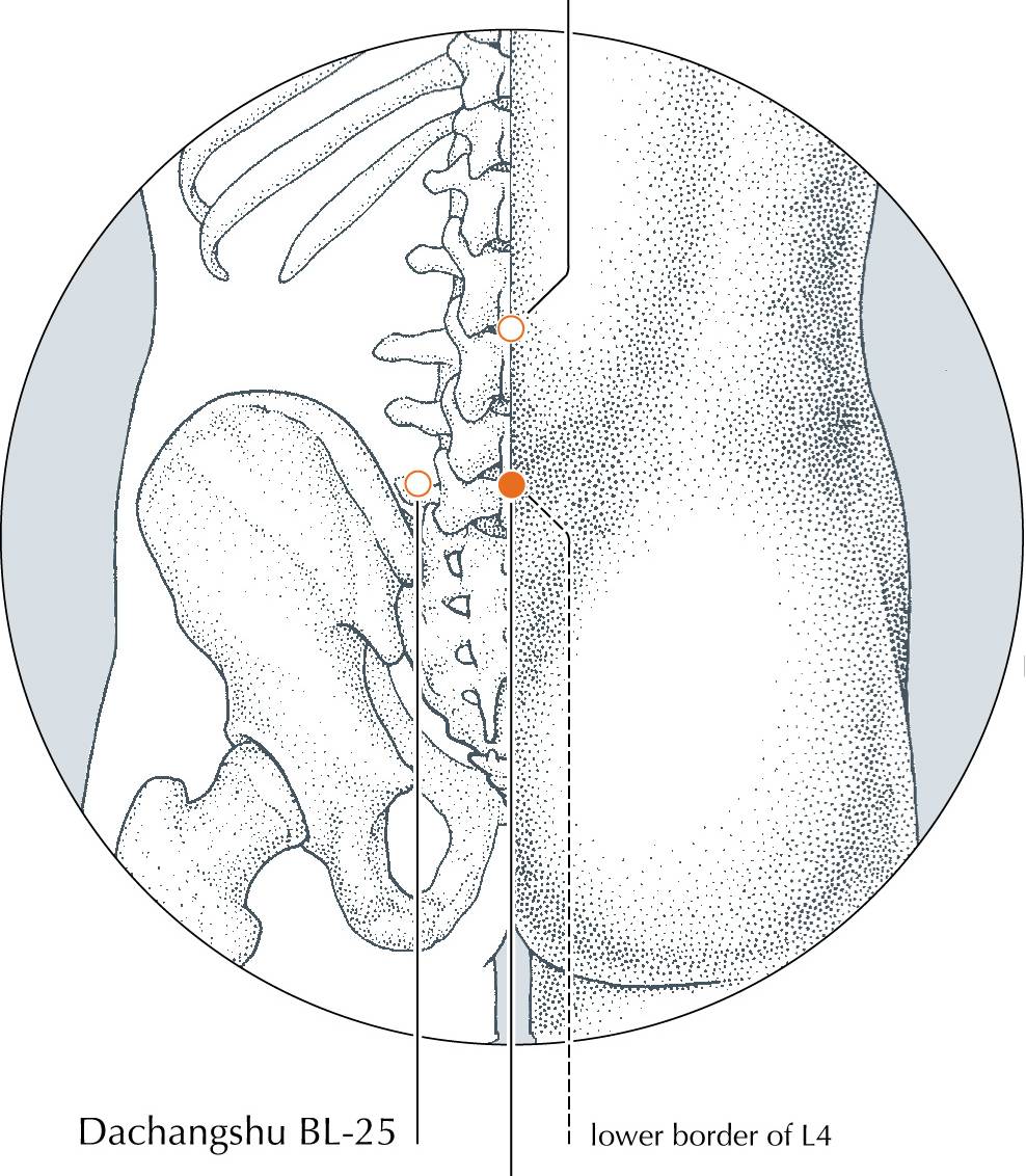 <p>DU-3</p>