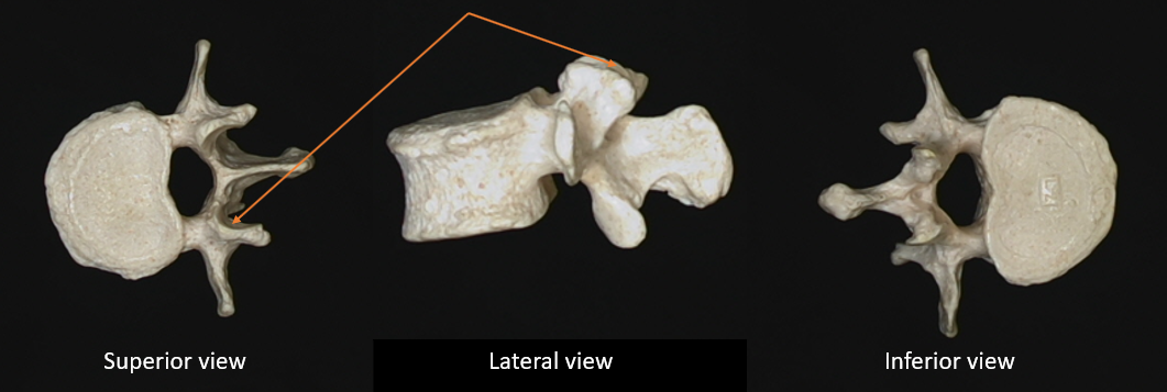 superior articulating facet 