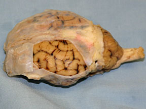 <p>Dura Mater</p>