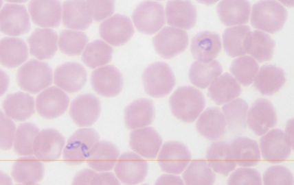 <p>What species does Babesia spp.: B. canis, B. gibsoni, B. bovis infect</p>