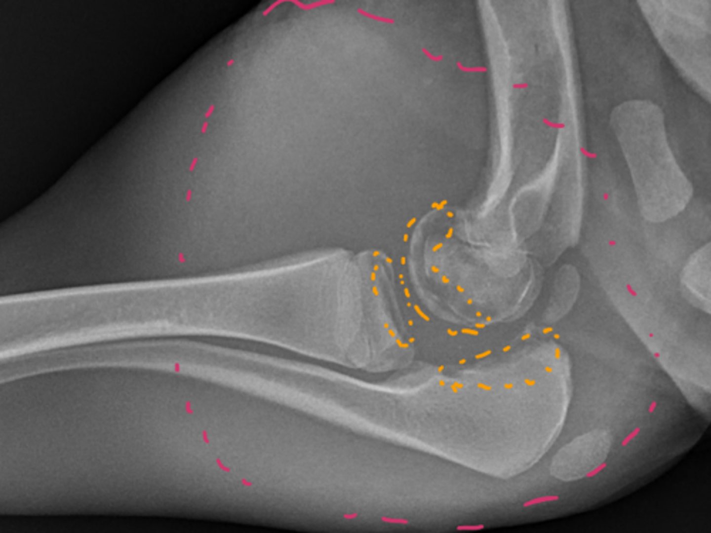 <p>Identify the joint changes?</p>