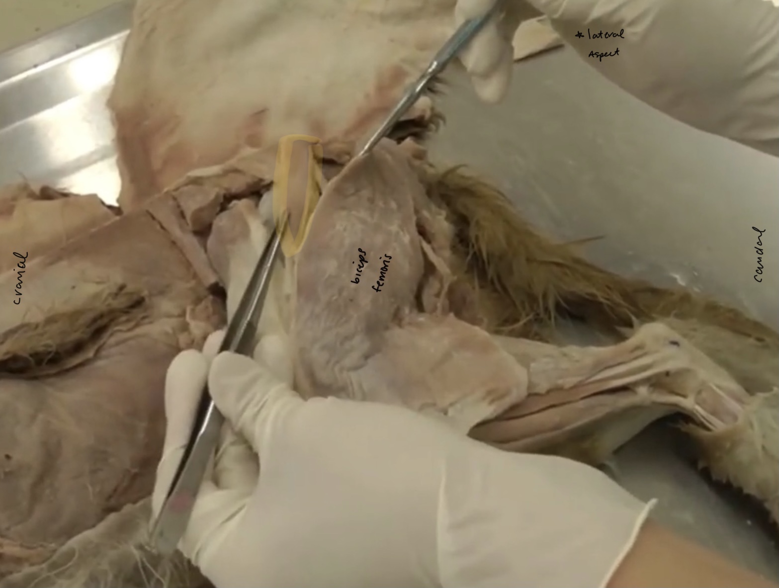 <p>What is the yellow highlighted muscle?</p>
