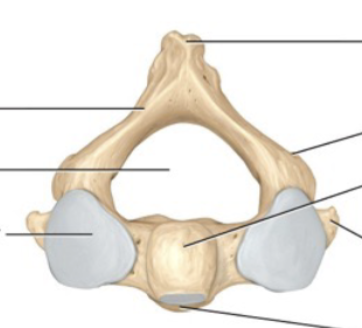 <p>Axis</p>