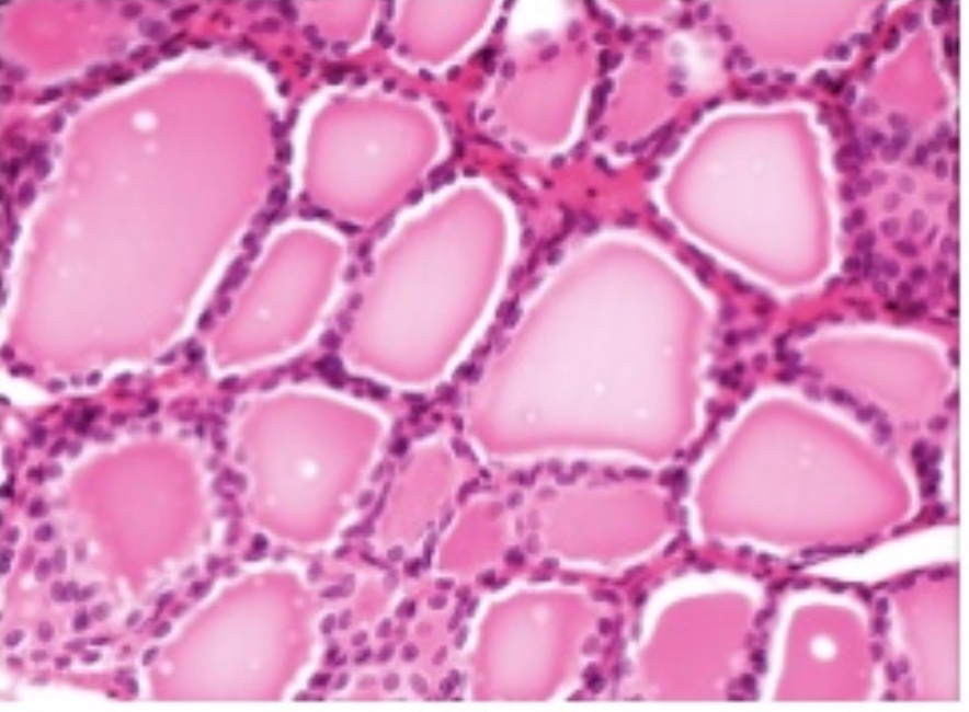 <p>Thyroid Gland</p>