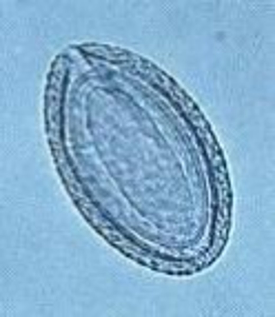 <p>Thorny headed worm of swine</p>
