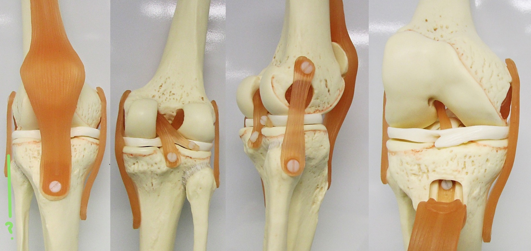 <p>Determine the part of the knee joint w/ ligament highlighted</p>