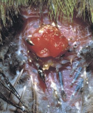 <p>What disease condition is caused by psittacid herpesvirus 1, affects mainly macaws and Amazon parrots, forms papillomas in the oral cavity and cloaca which can come and go and then spread to the GI tract? There will be blood in droppings, papilloma prolapses in the cloaca, upper GI signs (wasting disease, regurgitation), bile duct/pancreatic duct carcinomas in some birds, and chronic liver disease. It is diagnosed with PE or PCR, and is treated only with surgery, Acyclovir is not effective.</p>