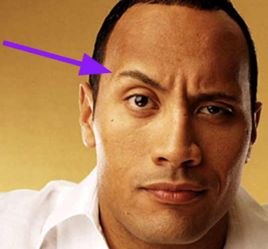 <p><span style="font-family: "Times New Roman", serif"><strong>Which muscle brings the eyebrow up?</strong></span></p>