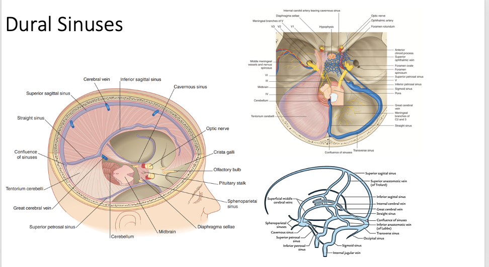 <p>meeting place for superior sagittal, straight, occipital and transverse sinuses; located at the internal occipital protuberance</p>