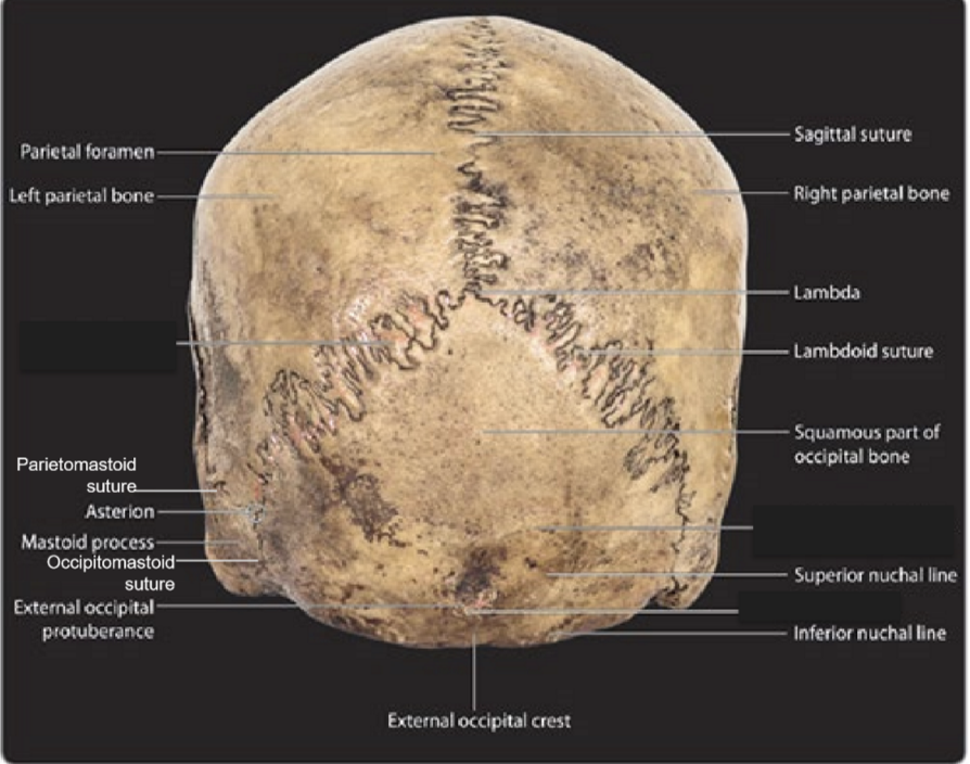 <p>Bones visible: 2 parietal bones, occipital bone, 2 temporal bones</p><p>Sutures: Sagittal, lambdoid, parietomastoid, occipitomastoid </p><p>Foramen: 2 parietal foramen</p><p>Craniometric points visible: lambda, asterion </p>