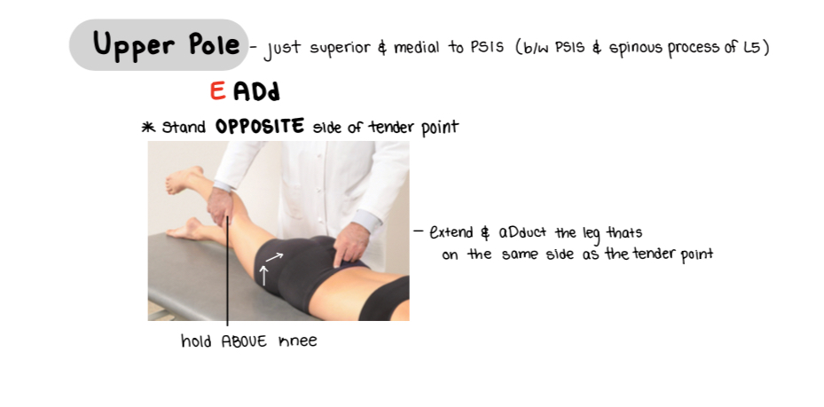 <p>Point is superior and medial to PSIS</p><ol><li><p>Pt is prone</p></li><li><p>Stand on opposite side</p></li><li><p>Hold pt leg of the tender point above knee</p></li><li><p>Extend and ADduct</p></li></ol><p></p>