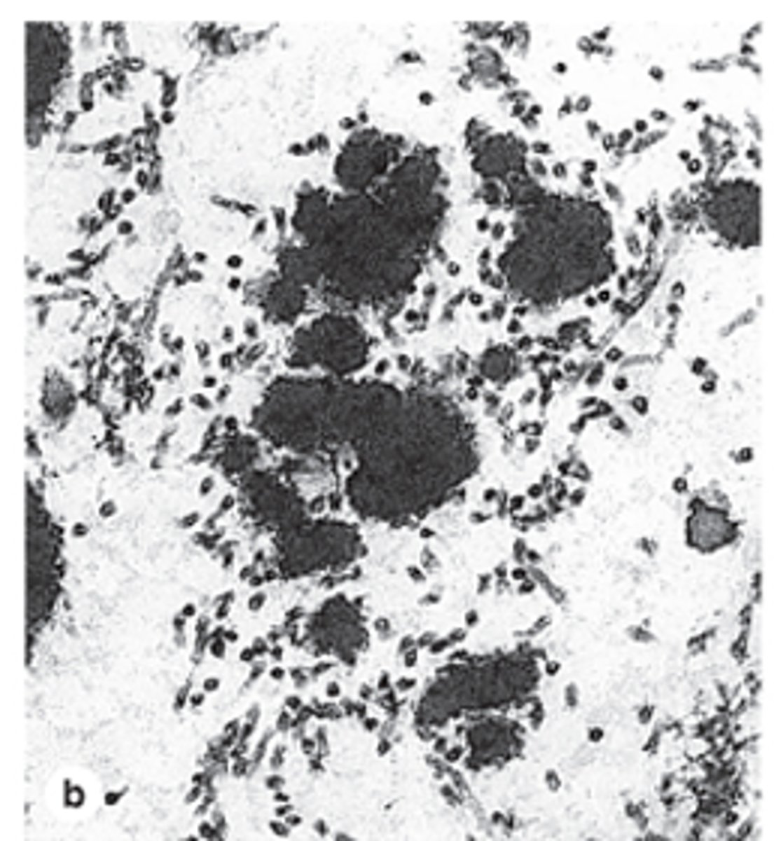 <p>How is elastin incorporated into elastic fibers?</p>