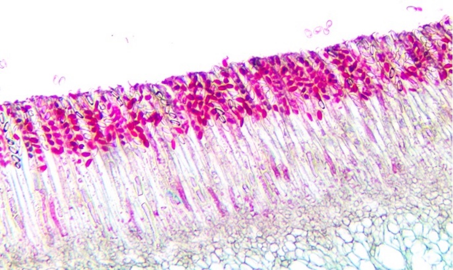 <p>The dark pink structures located toward the top of this Peziza ascus are called:</p><ul><li><p>Ascospores</p></li><li><p>Basidiospores</p></li><li><p>Conidiospores</p></li><li><p>Sporangia</p></li></ul><p></p>