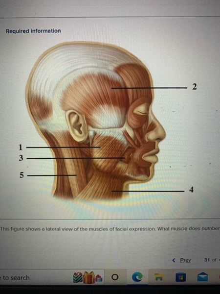 <p>Masseter</p>