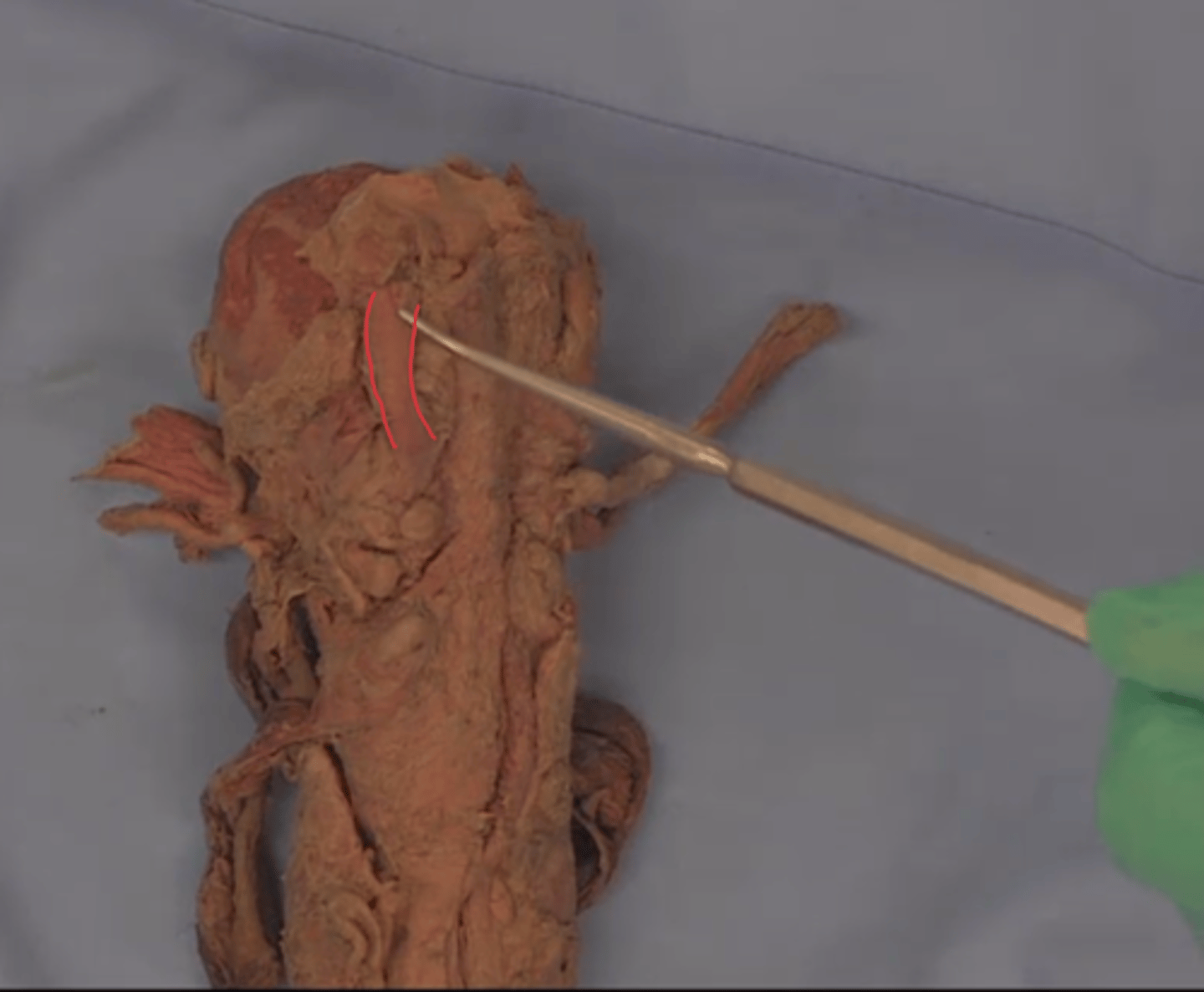 <p>What is this structure?</p>