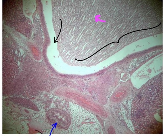 <p>specimen in the field of view?</p><p>bracketed structure?</p><p>space at tip of black pointer</p><p>liquid found in that space?</p><p>specific tissue lining the lumen</p><p>structure at tip of magenta pointer</p><p>structure at tip of blue pointer</p>