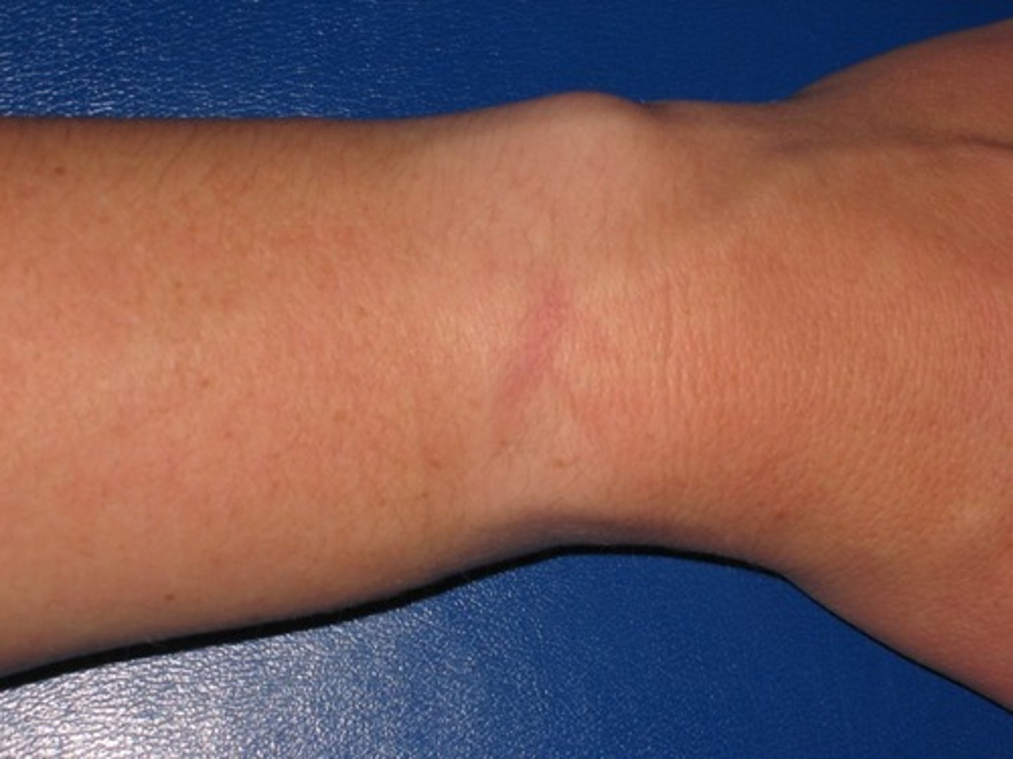 <p>wrist, noun</p>