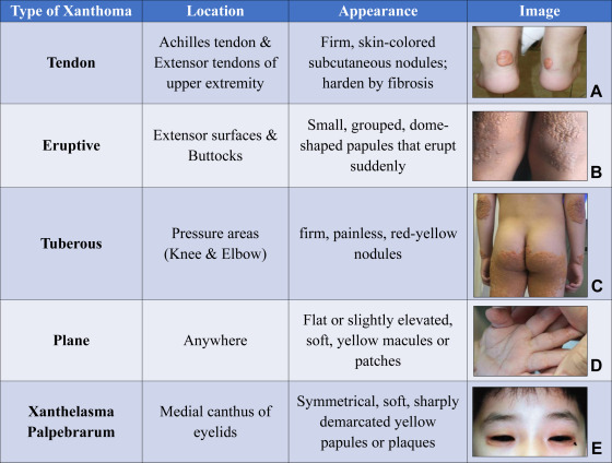 <ol><li><p>eruptive</p></li><li><p>tuberous</p></li><li><p>xanthelasma</p></li></ol><p></p>