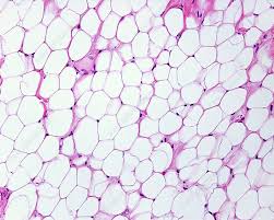 <p>Connective tissue that stores fat.</p>