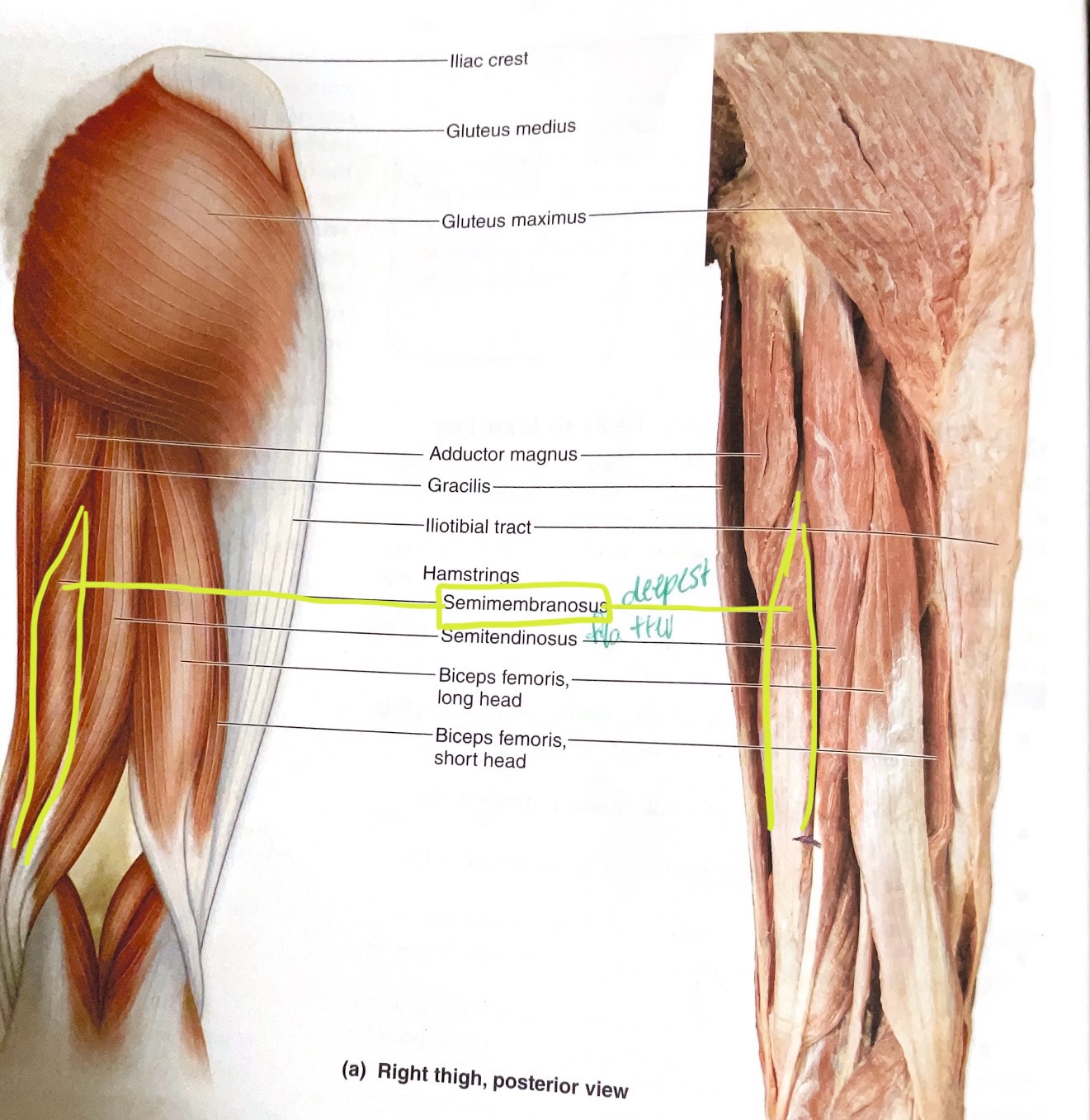 <p>Origin: Ischial Tuberosity </p><p>Insertion: Medil condyle of tibia</p><p>Action:Extend hip; flex knee</p>