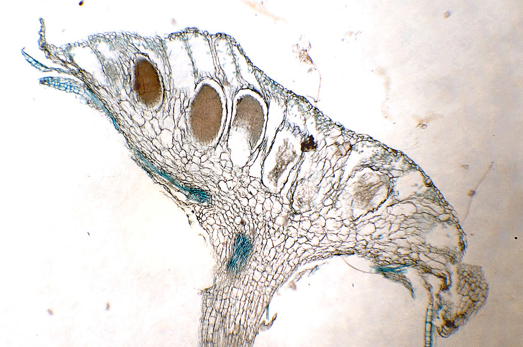 <p>Which division does this Antheridial Head belong to?</p>