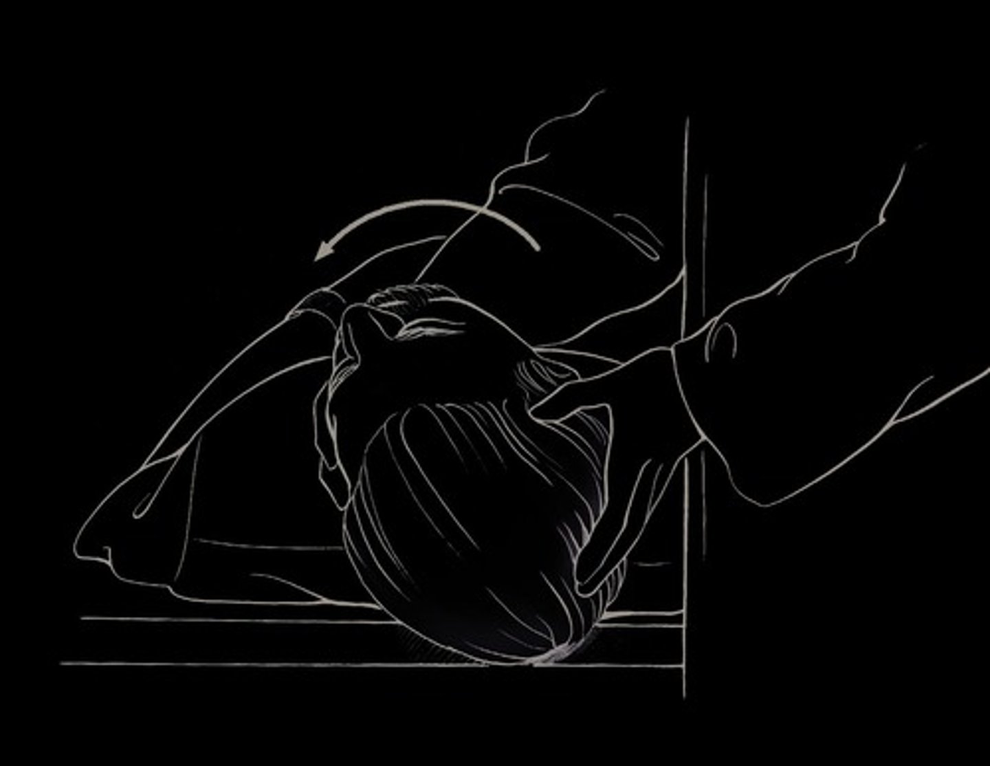 <p>A canalith repositioning procedure used to treat BPPV.</p>